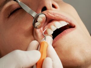 Going Beyond The Smile: The Real Deal On Elective Dental Work